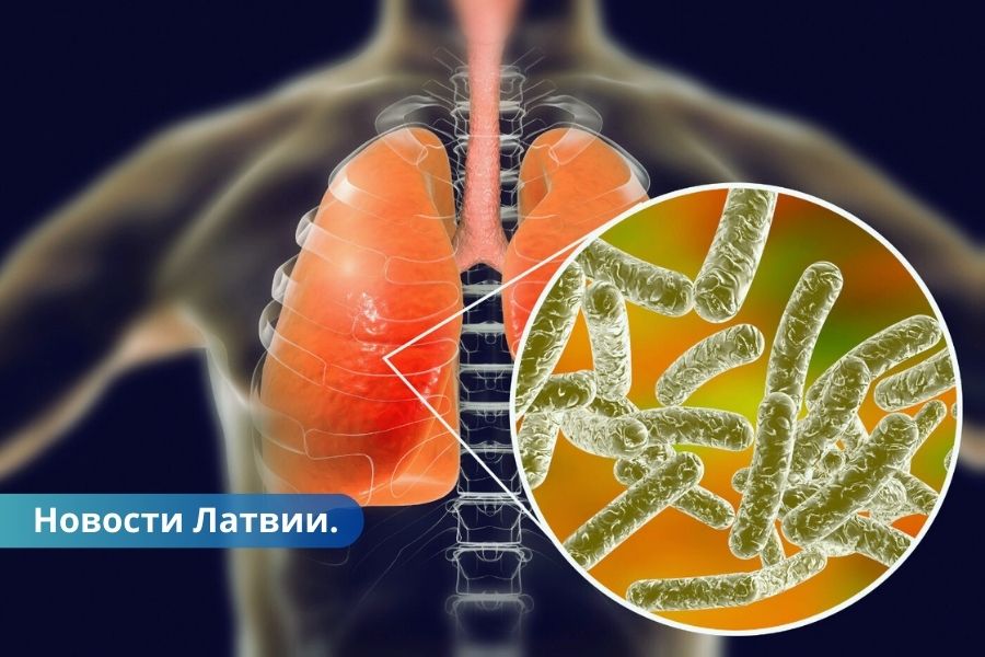 Распространяется легионеллез с начала года диагностирован у 17 человек.