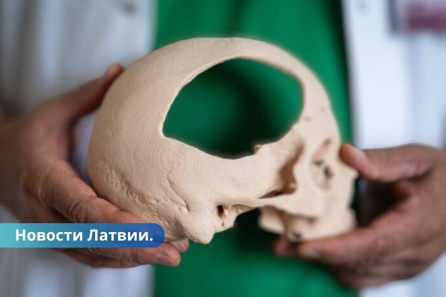 ФОТО: в Латвии подростку заменили часть черепа на 3D-печатную кость.