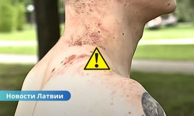 Видео ⟩ чудо в Риге: мужчина выжил после удара молнии.