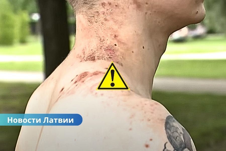 Видео ⟩ чудо в Риге: мужчина выжил после удара молнии.