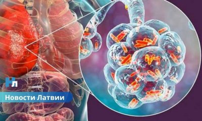 🚨В Юрмале обнаружен легионеллез: опасная бактерия в воде — что делать и как защититься?