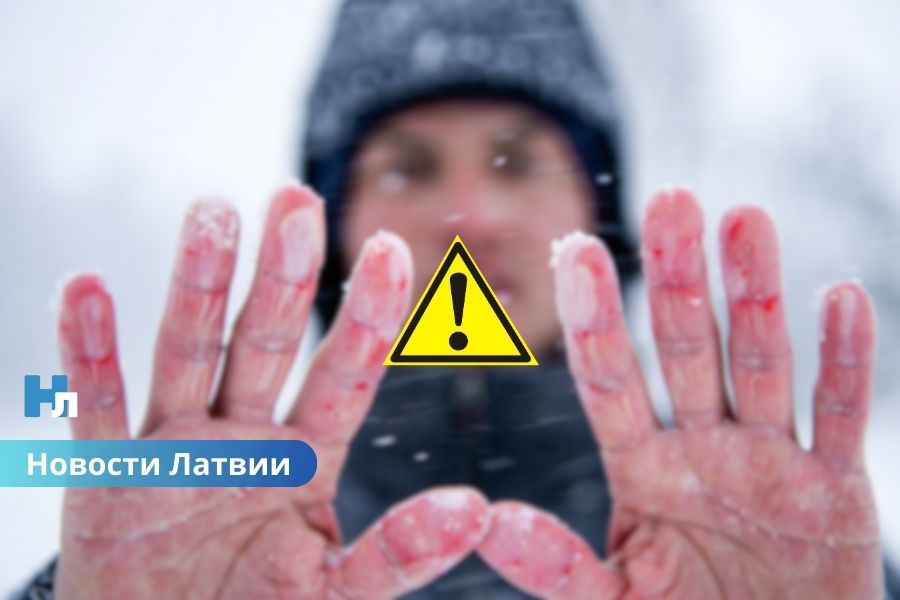 Морозы калечат: семи пациентам RAKUS грозит ампутация из-за тяжёлых обморожений.