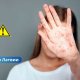 В Латвии зарегистрировано уже 42 заболевших корью: врачи комментируют ситуацию.